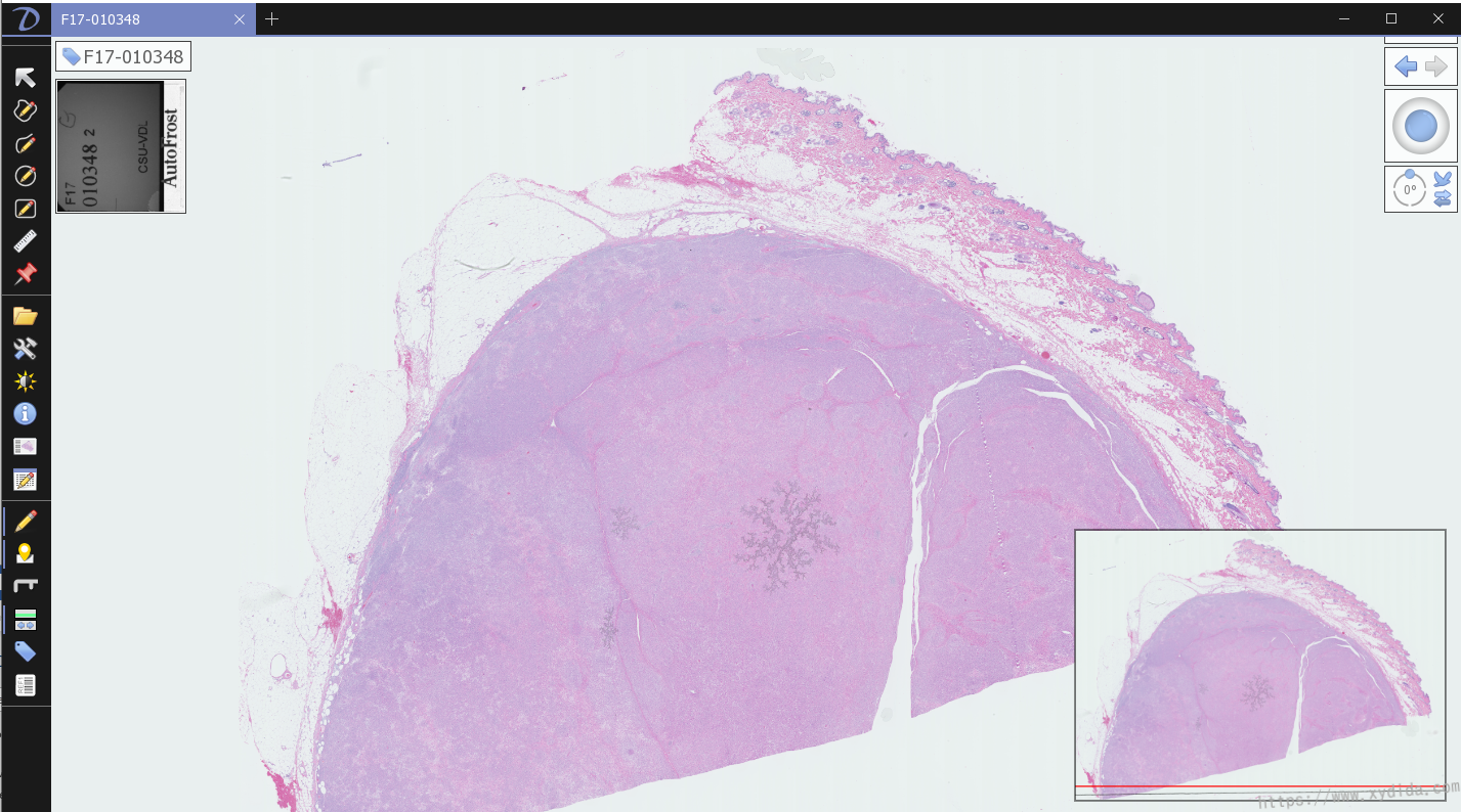 Fig. 1 Example of a WSI